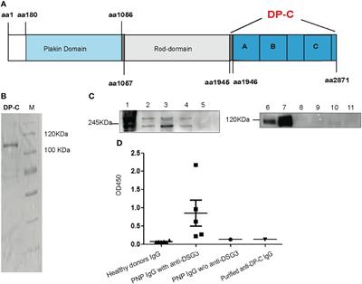 Paraneoplastic Pemphigus Autoantibodies Against C-terminus of Desmoplakin Induced Acantholysis In Vitro and In Vivo